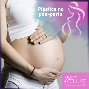 Leia mais sobre o artigo Plástica na pós gravidez