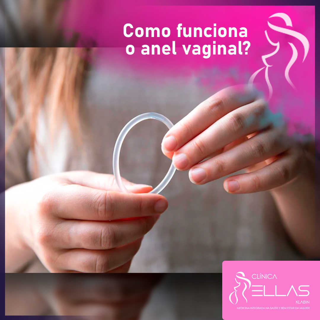 Como funciona o Anel Vaginal?